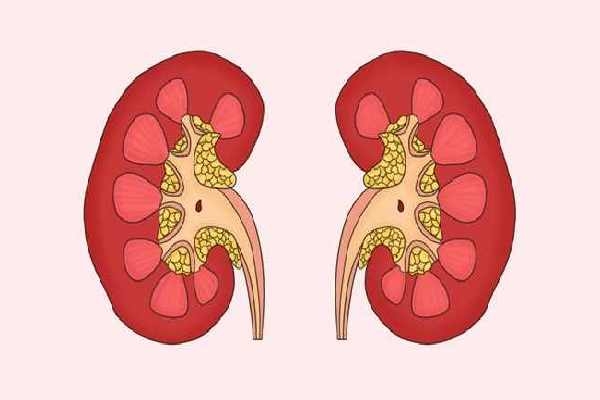 什么人应该少吃腰果？