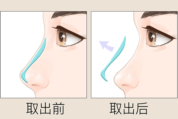 长春整形外科最好的医院排名