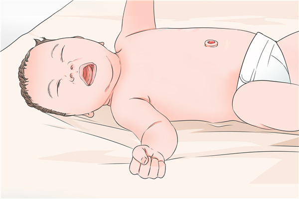 新生儿百日咳能治好吗