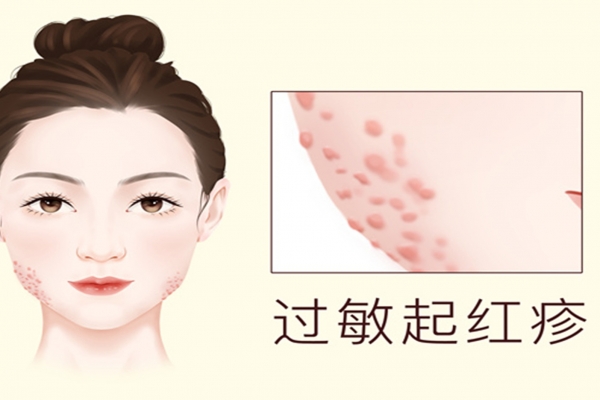 海蛎吃多了有什么危害