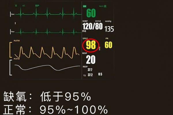 血氧低吃什么提高的快