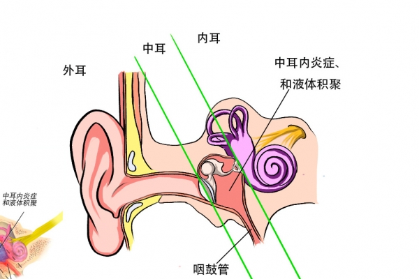 流感和普通感冒的症状区别