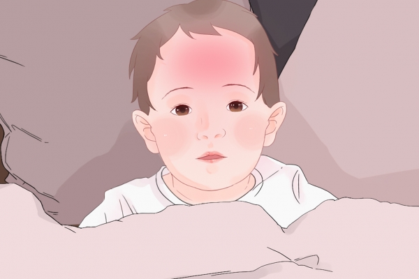儿童治疗中暑小妙招