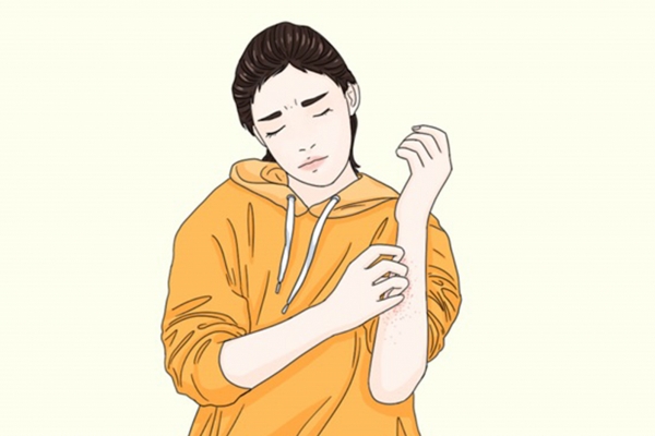 过敏体质怎么改善