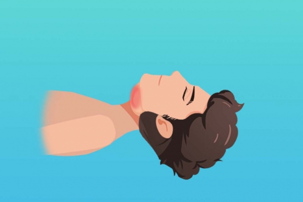 落枕了怎么快速恢复